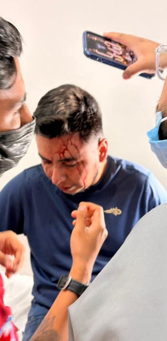 . La agresión solo cesó cuando su esposa y su suegra salieron al auxilio, provocando la huida
