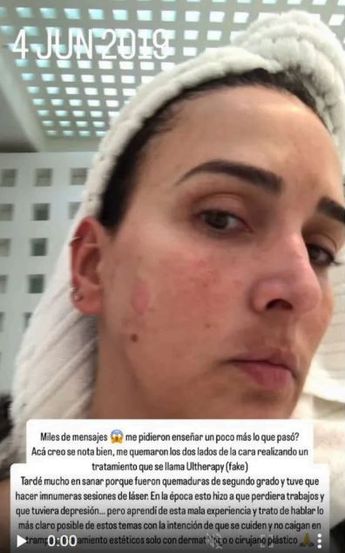 Imágenes compartidas por la modelo a través de sus historias de Instagram | Especial